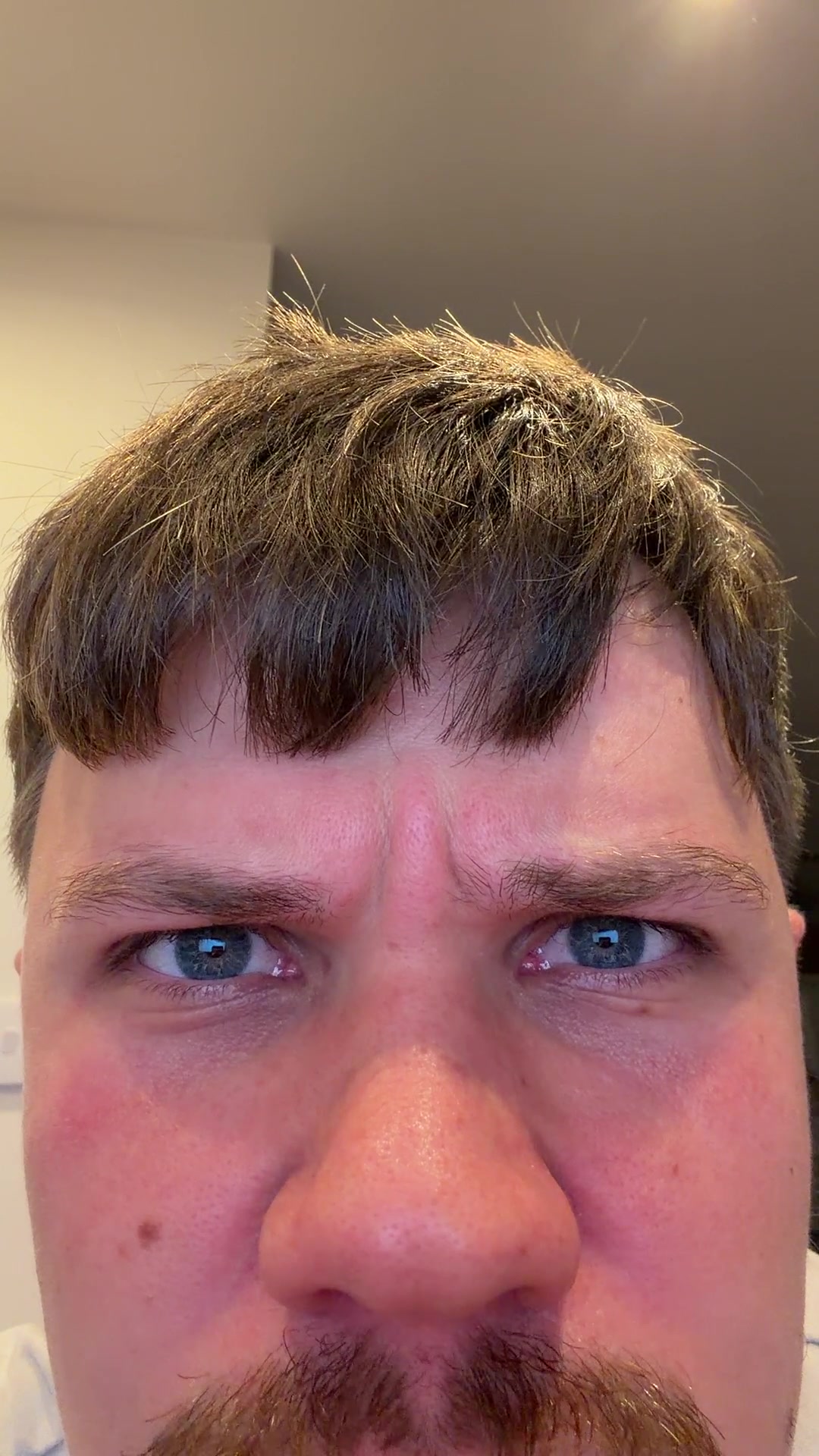 Man Reacts with Squint and Surprise